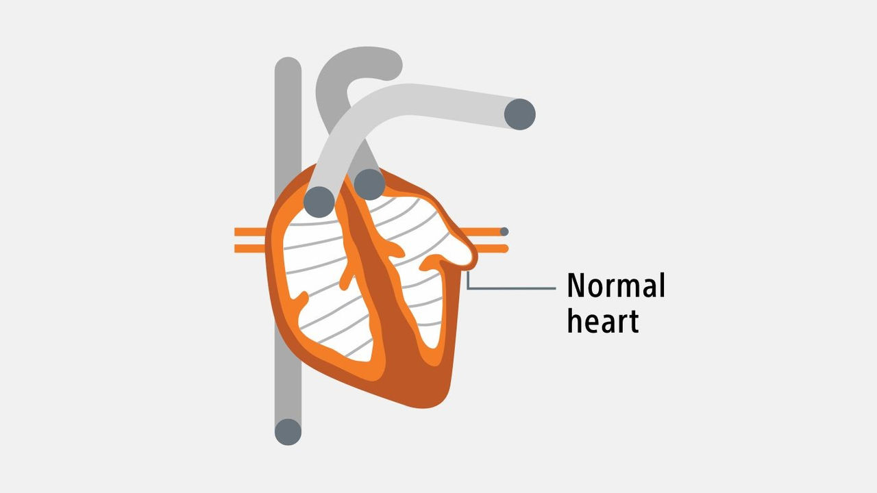 Heart image.