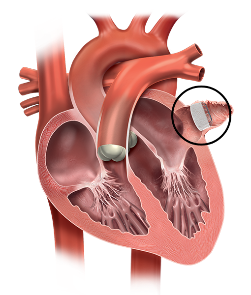 Heart image.
